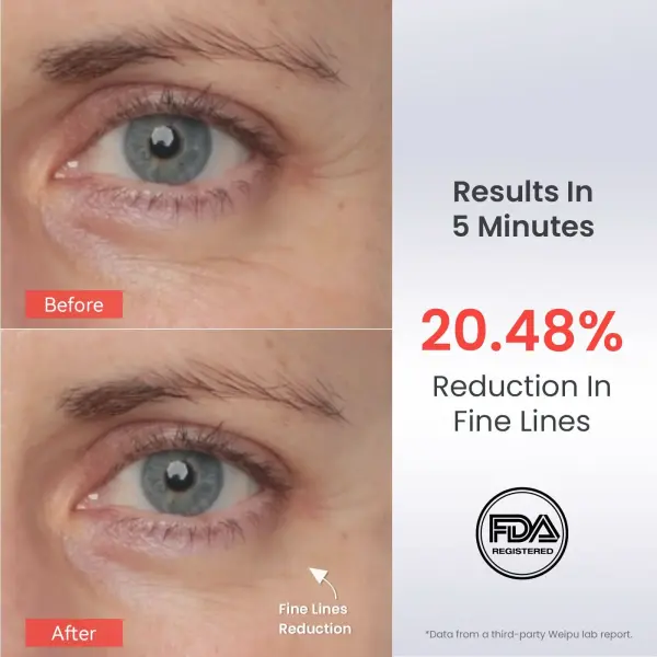 AMIRO EyeGlow Rotlicht- und Mikrostrom-Augencreme