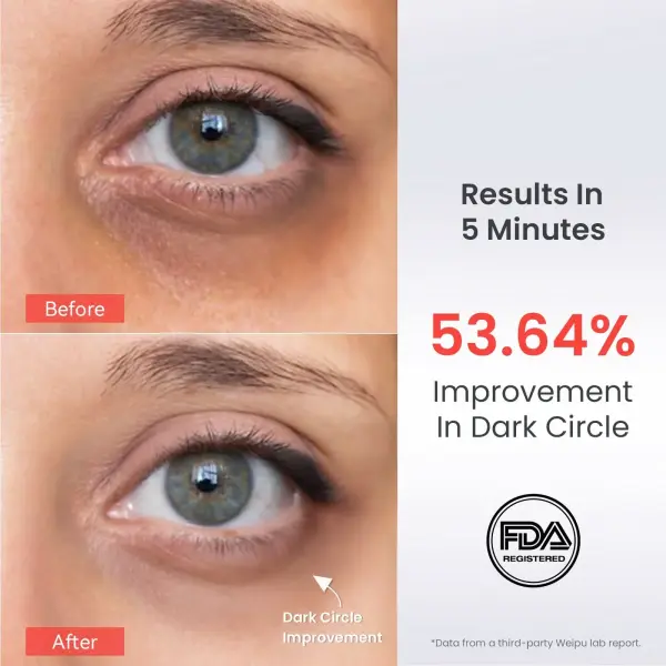 AMIRO EyeGlow Rotlicht- und Mikrostrom-Augencreme